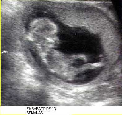 embarazo 13 semanas